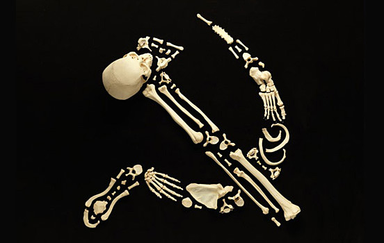 bone Art